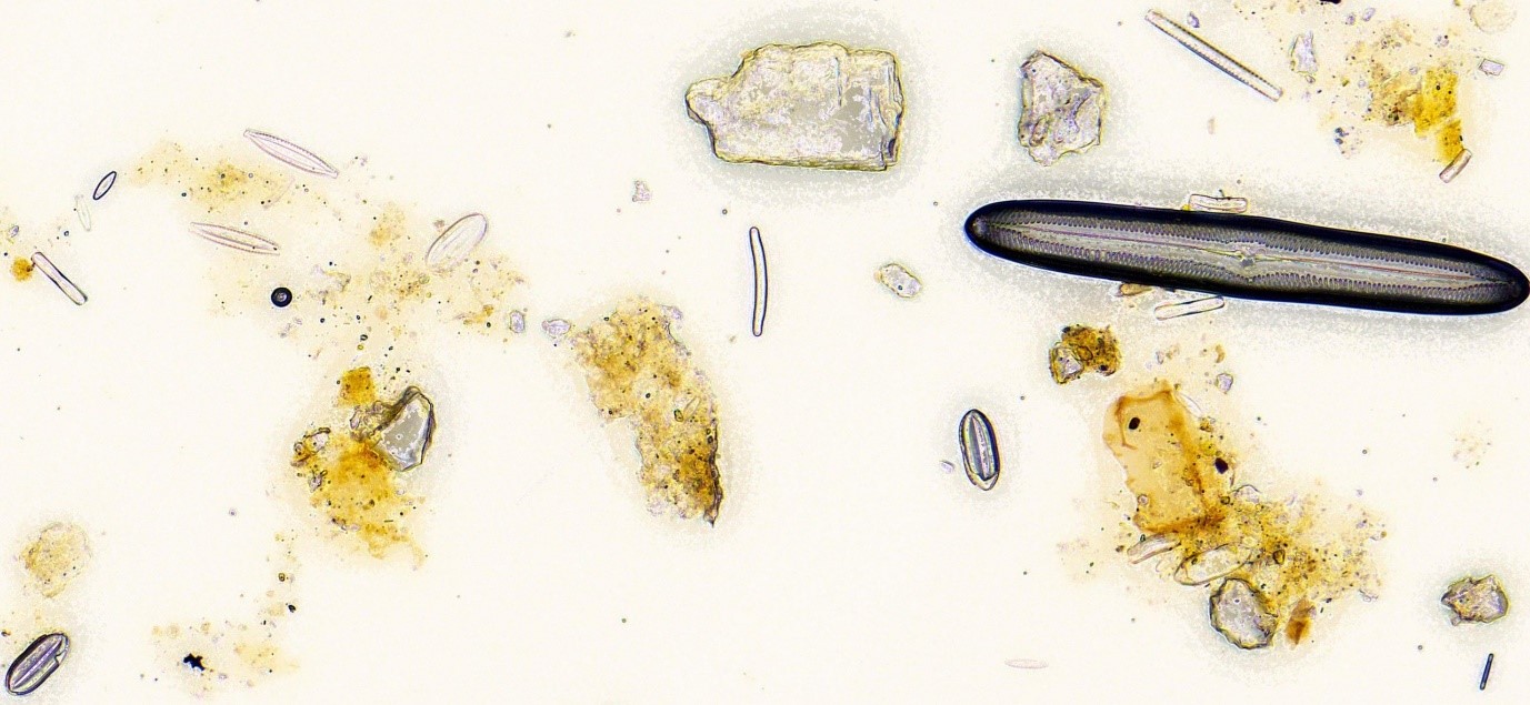 Deep Dive Into Forensic Science: The Role Of Diatom Analysis